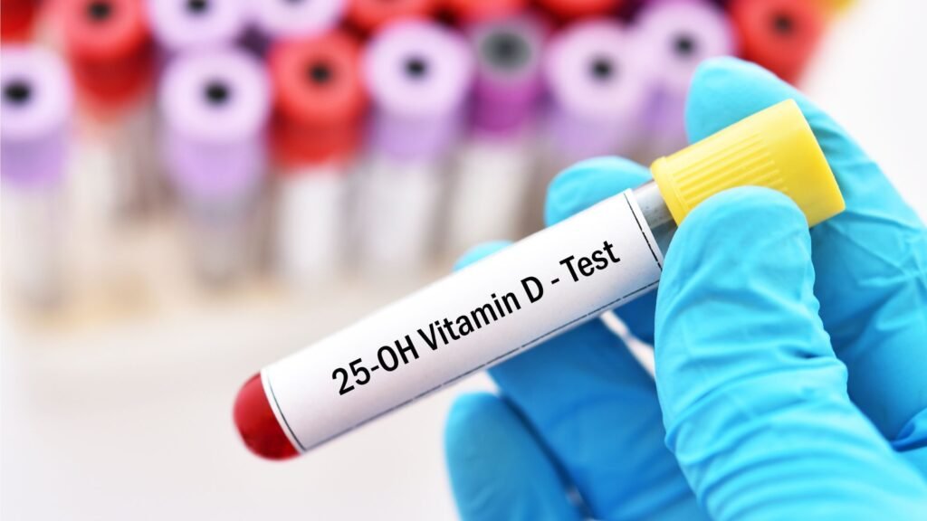 Pharmacy vitamin D advice